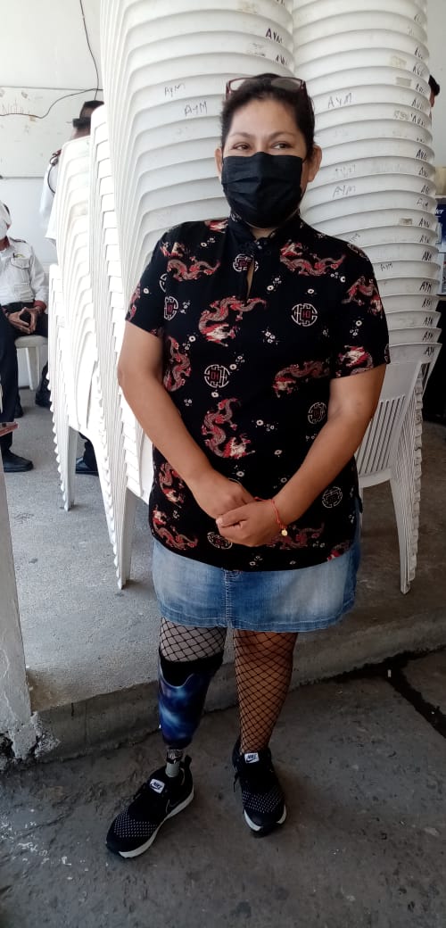 HASTA UN 60% DE LESIONADOS EN ACCIDENTES VIALES, PIERDEN ALGUNA EXTREMIDAD.