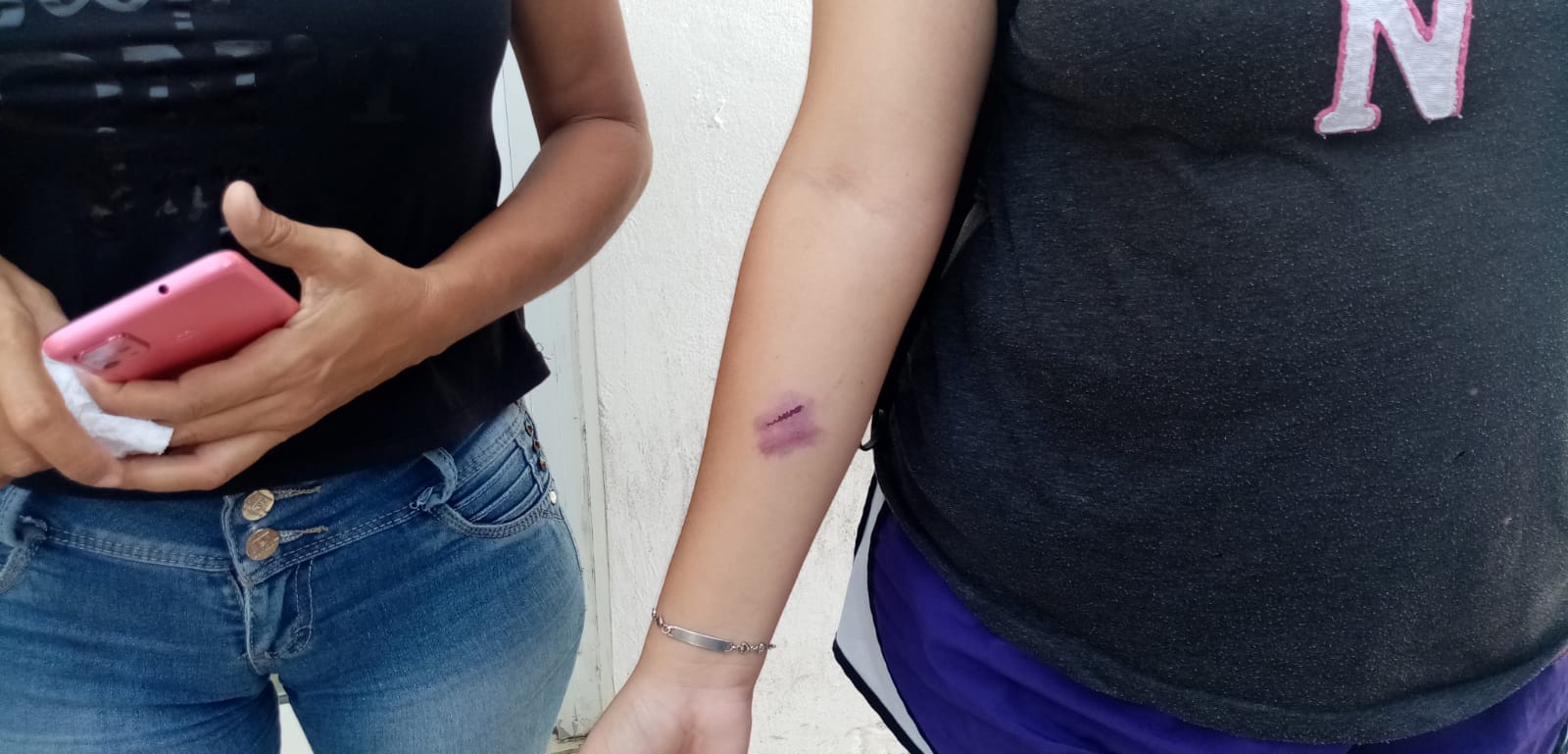 MADRE E HIJA FUERON AGREDIDAS A GOLPES POR PARTE DE UNA VECINA CONFLICTIVA.