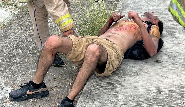 JOVEN SE ELECTROCUTA EN LAS INSTALACIONES DE LA CFE.