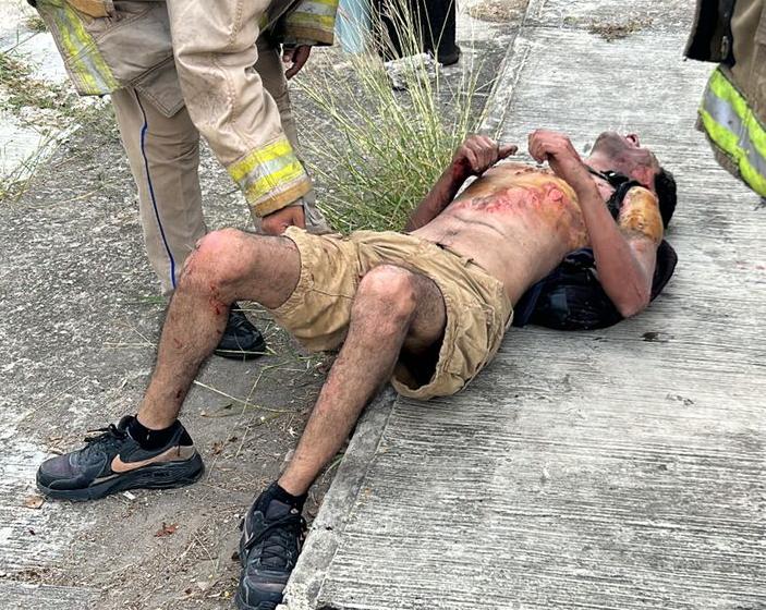 JOVEN SE ELECTROCUTA EN LAS INSTALACIONES DE LA CFE.