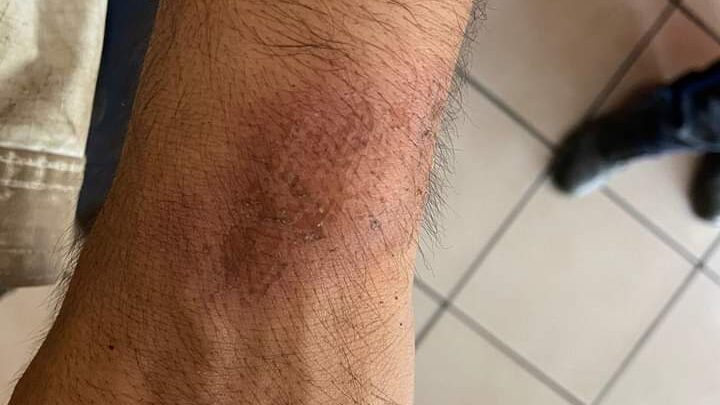 Golpean a Policías al Atender Riña Familiar