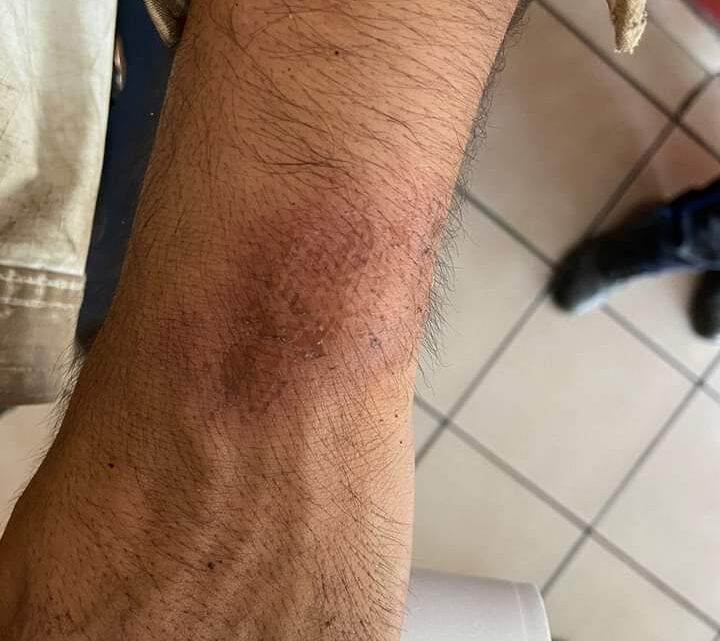 Golpean a Policías al Atender Riña Familiar Golpean a Policías al Atender Riña Familiar