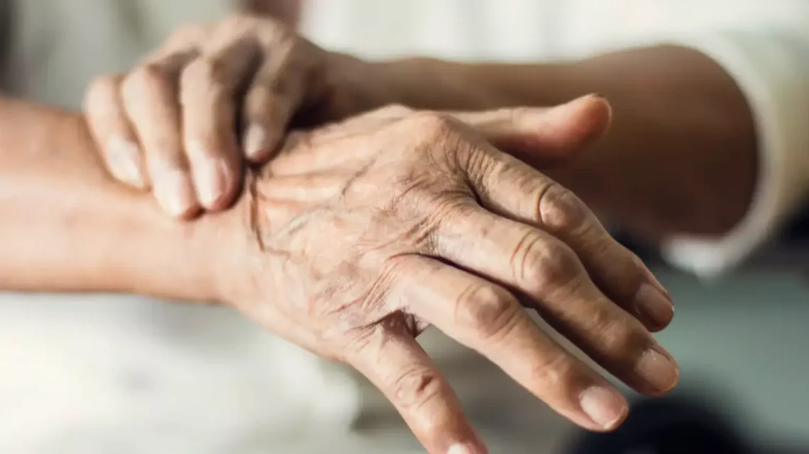 EL PARKINSON, ENFERMEDAD CONSIDERADA DE SALUD PÚBLICA EL PARKINSON, ENFERMEDAD CONSIDERADA DE SALUD PÚBLICA