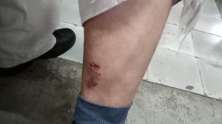 PROTESTAN VECINOS POR ATAQUES DE PERROS EN COLONIA ÁRBOL GRANDE.