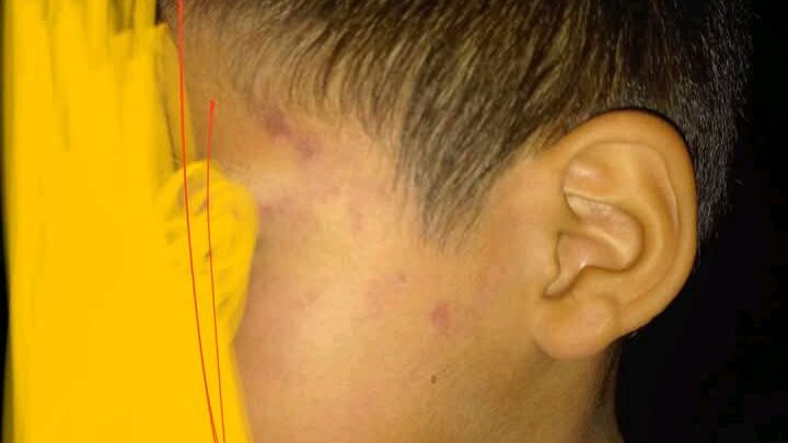 DIF MADERO INVESTIGA PRESUNTO CASO DE MALTRATO INFANTIL TRAS DENUNCIA EN REDES SOCIALES