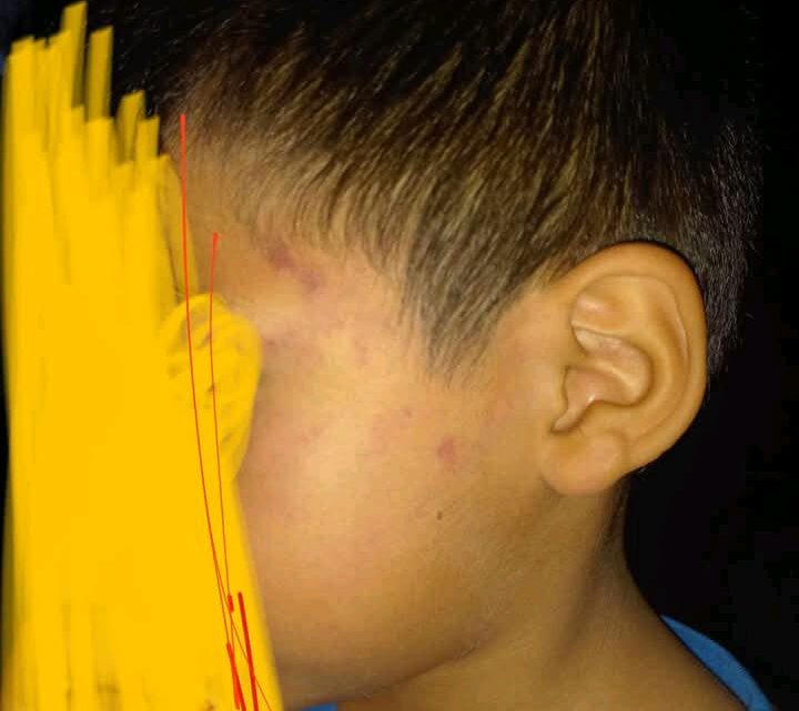 DIF MADERO INVESTIGA PRESUNTO CASO DE MALTRATO INFANTIL TRAS DENUNCIA EN REDES SOCIALES